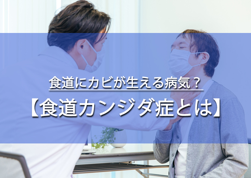 食道にカビが生える「食道カンジダ症」とは？